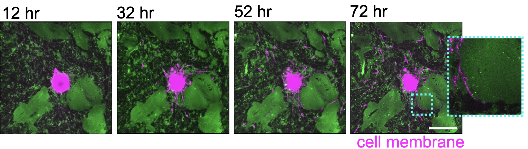 Time lapse showing cells spreading over time in the hydrogel. 